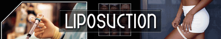 Liposuction header image